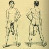 Weird Medical Condition of the Day: Diphallia; Or, Two Penises Are Better Than One